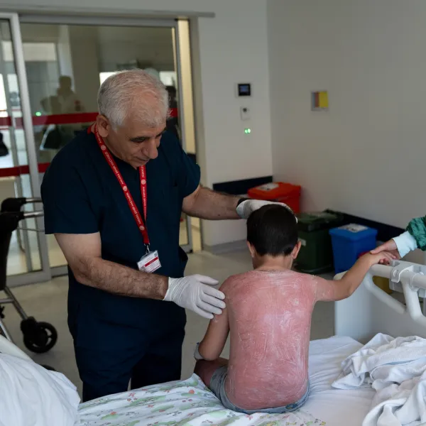 Güneşte 4 saat kaldı! 2. derece yanıkla hastanelik oldu