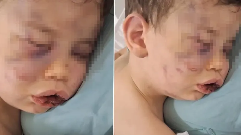 2 Yaşındaki Bebek Şoke Etti! Annesinin Arkadaşı Neler Yaptı?