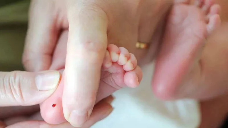 PKU Hastaları Dikkat! Kurban Bayramı Beslenme Uyarısı